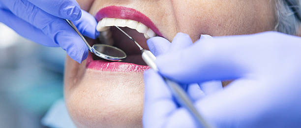 Best Emergency Denture Repair in Winfield, IL